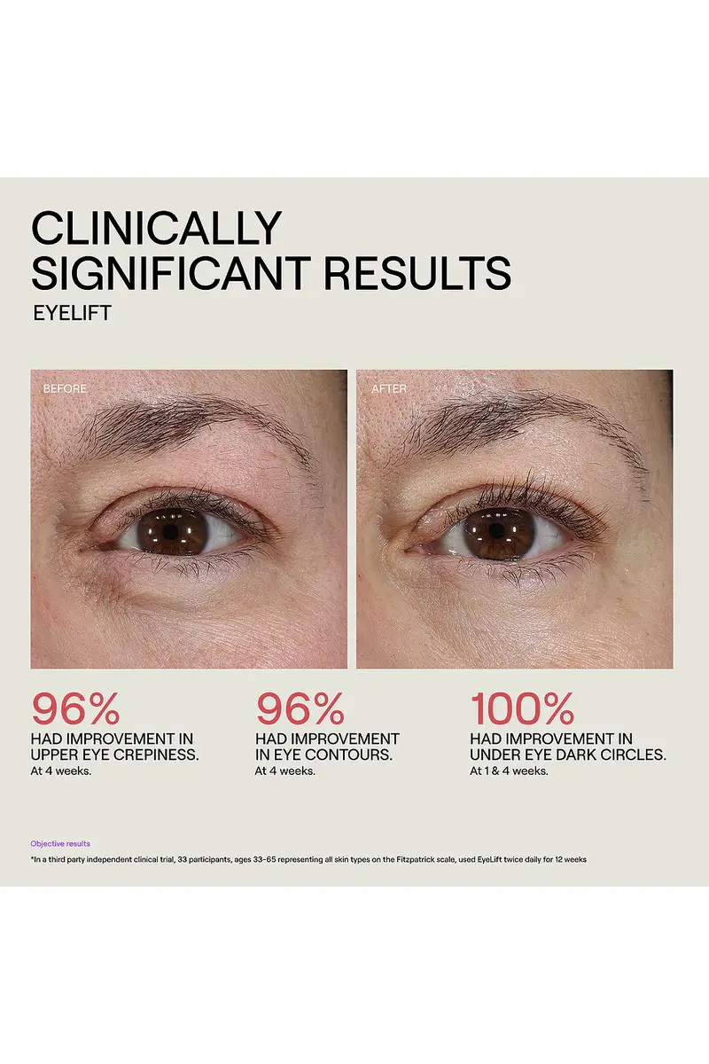 Dr. Diamond's Metacine EyeLift Bioremodeling Peptide Multiplex | Thumbnail 6 Dr. Diamond's Metacine EyeLift Bioremodeling Peptide Multiplex | Thumbnail 6