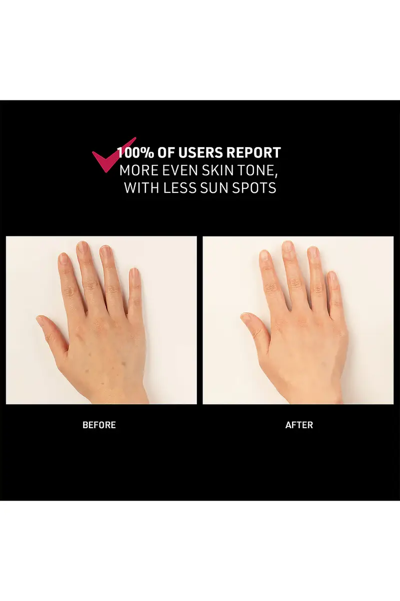 Foreo FAQ 221 Hand LED Anti-Aging Mask | Thumbnail 5 Foreo FAQ 221 Hand LED Anti-Aging Mask | Thumbnail 5
