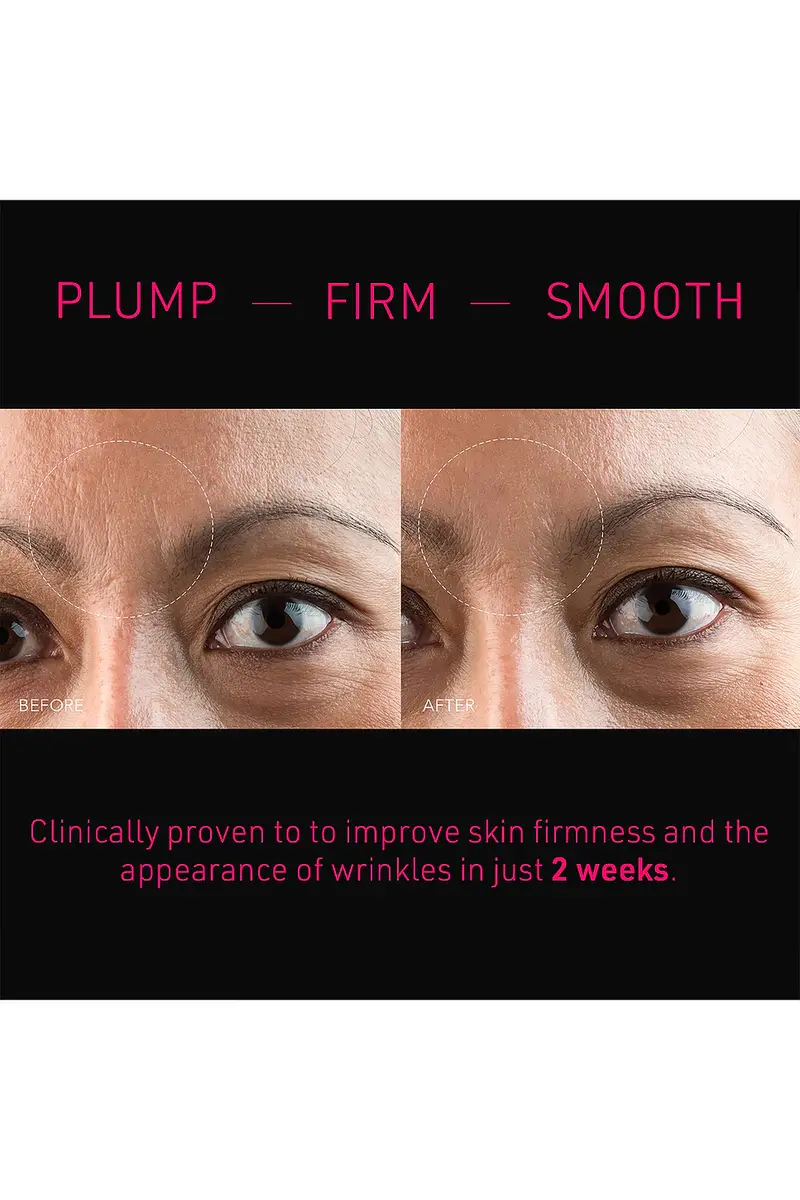 Foreo FAQ Microneedling Anti-Wrinkle Hyaluronic Acid Patches For Forehead 3 Pack | Thumbnail 4 Foreo FAQ Microneedling Anti-Wrinkle Hyaluronic Acid Patches For Forehead 3 Pack | Thumbnail 4