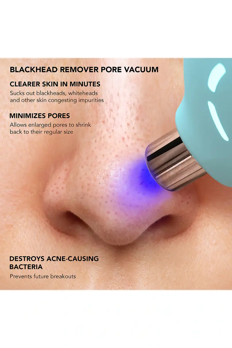 Foreo KIWI Blackhead Remover Device | Thumbnail 5 Foreo KIWI Blackhead Remover Device | Thumbnail 5