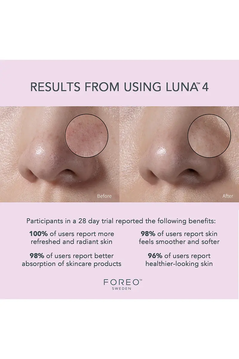Foreo Luna 4 Facial Cleansing & Firming Device For Sensitive Skin | Thumbnail 4