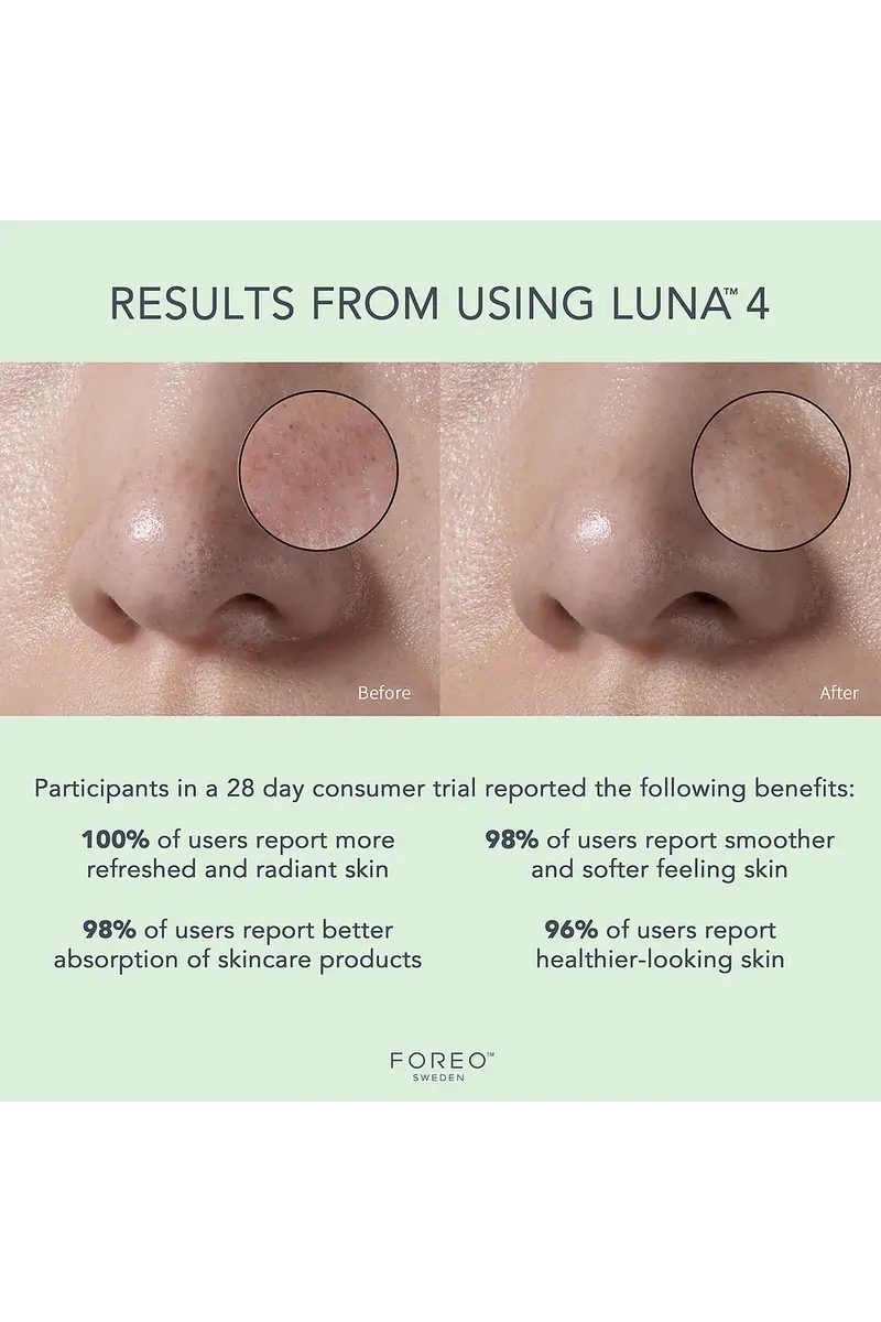 Foreo Luna 4 Facial Cleansing & Firming Device For Combination Skin | Thumbnail 4