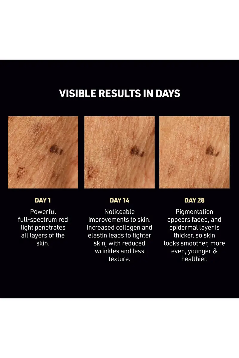 Foreo FAQ 502 DPL Photorejuvenation Skin Renewal Device | Thumbnail 7