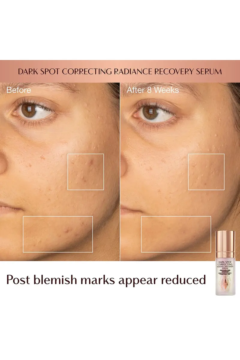 Charlotte Tilbury Dark Spot Correcting Hydration Revival Duo | Thumbnail 4