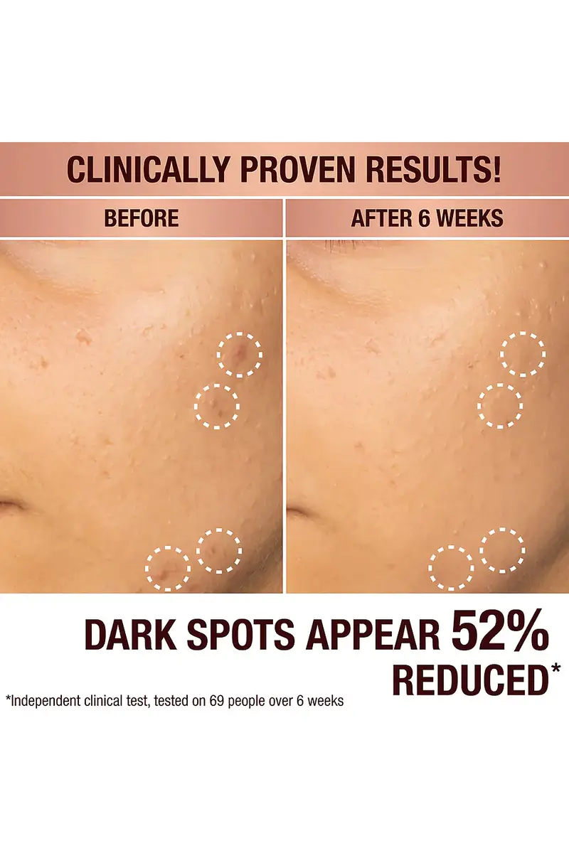 Charlotte Tilbury Dark Spot Correcting Radiance Recovery Serum 30ml | Thumbnail 2 Charlotte Tilbury Dark Spot Correcting Radiance Recovery Serum 30ml | Thumbnail 2
