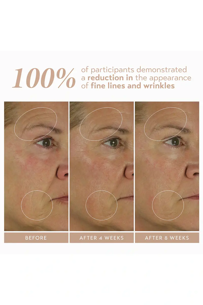 Shani Darden Skin Care Retinol Reform With 1% Encapsulated Retinol 10ml | Thumbnail 4