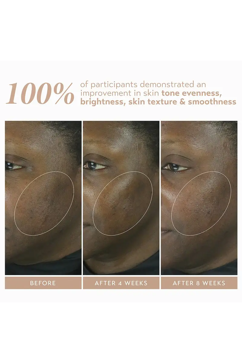 Shani Darden Skin Care Retinol Reform With 1% Encapsulated Retinol 10ml | Thumbnail 5