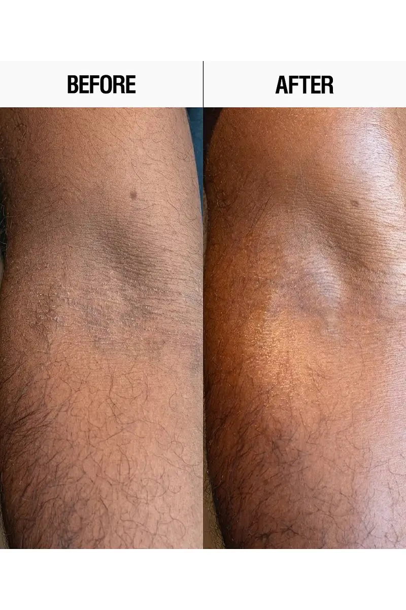 Grown Alchemist Resurfacing Targeted Body Lotion | Thumbnail 3 Grown Alchemist Resurfacing Targeted Body Lotion | Thumbnail 3