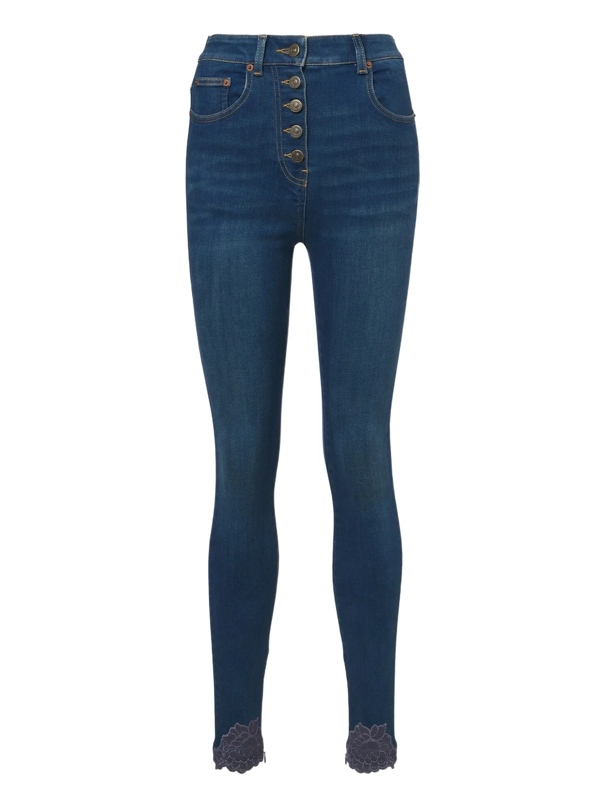 Lace-trimmed skinny jeans Lace-trimmed skinny jeans