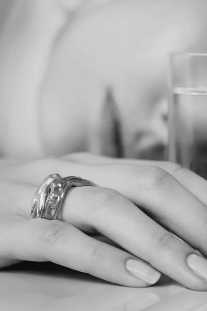 Simkhai Louise Ring | Thumbnail 5