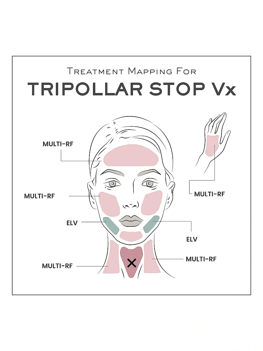 TriPollar Women's STOP Vx Facial Renewal, Reshaping & Rejuvenation Device | Thumbnail 6 TriPollar Women's STOP Vx Facial Renewal, Reshaping & Rejuvenation Device | Thumbnail 6
