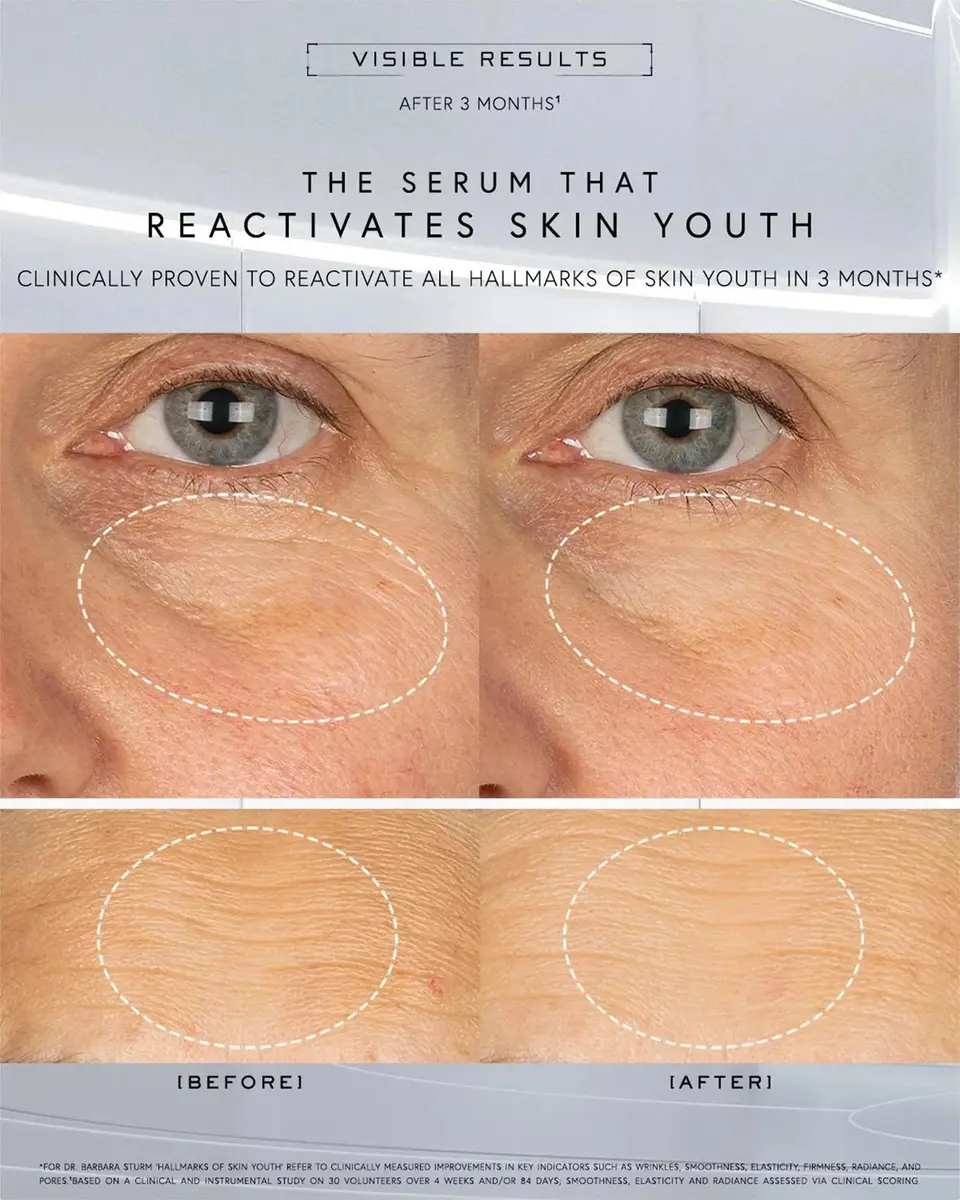 Dr. Barbara Sturm Super Anti-Aging Serum, 1 oz. | Thumbnail 2