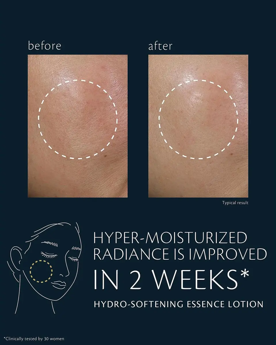 CLÉ DE PEAU BEAUTÉ Limited Edition Hydro-Softening Essence Refill Lotion | Thumbnail 5 CLÉ DE PEAU BEAUTÉ Limited Edition Hydro-Softening Essence Refill Lotion | Thumbnail 5