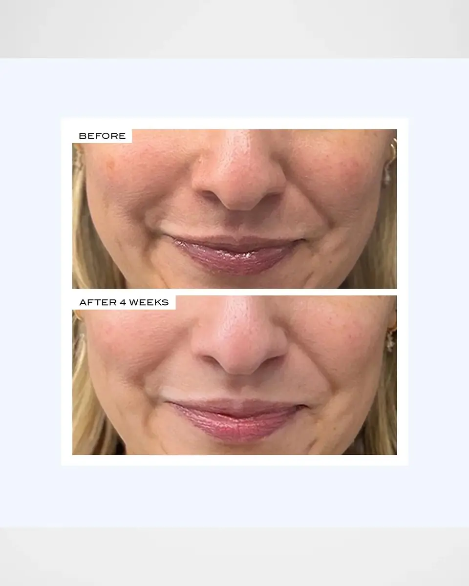 111SKIN Precision Peel, 1.35 oz. | Thumbnail 6 111SKIN Precision Peel, 1.35 oz. | Thumbnail 6