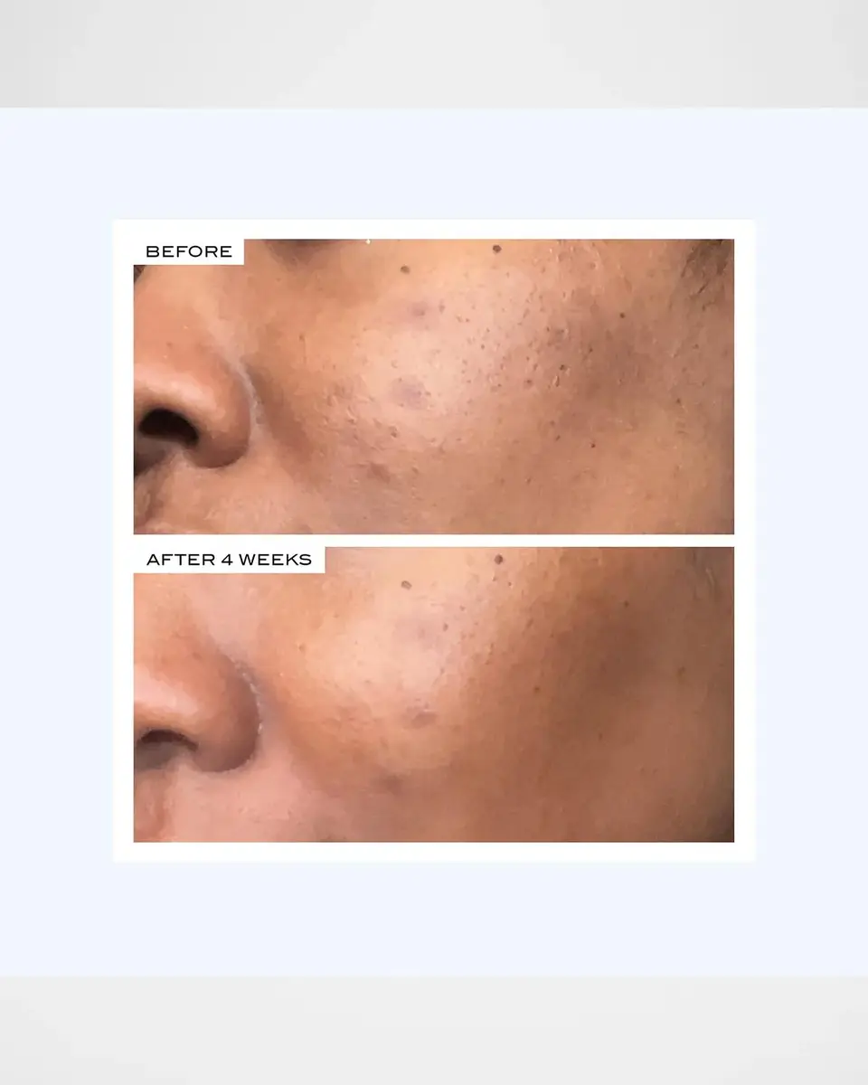 111SKIN Precision Peel, 1.35 oz. | Thumbnail 7 111SKIN Precision Peel, 1.35 oz. | Thumbnail 7
