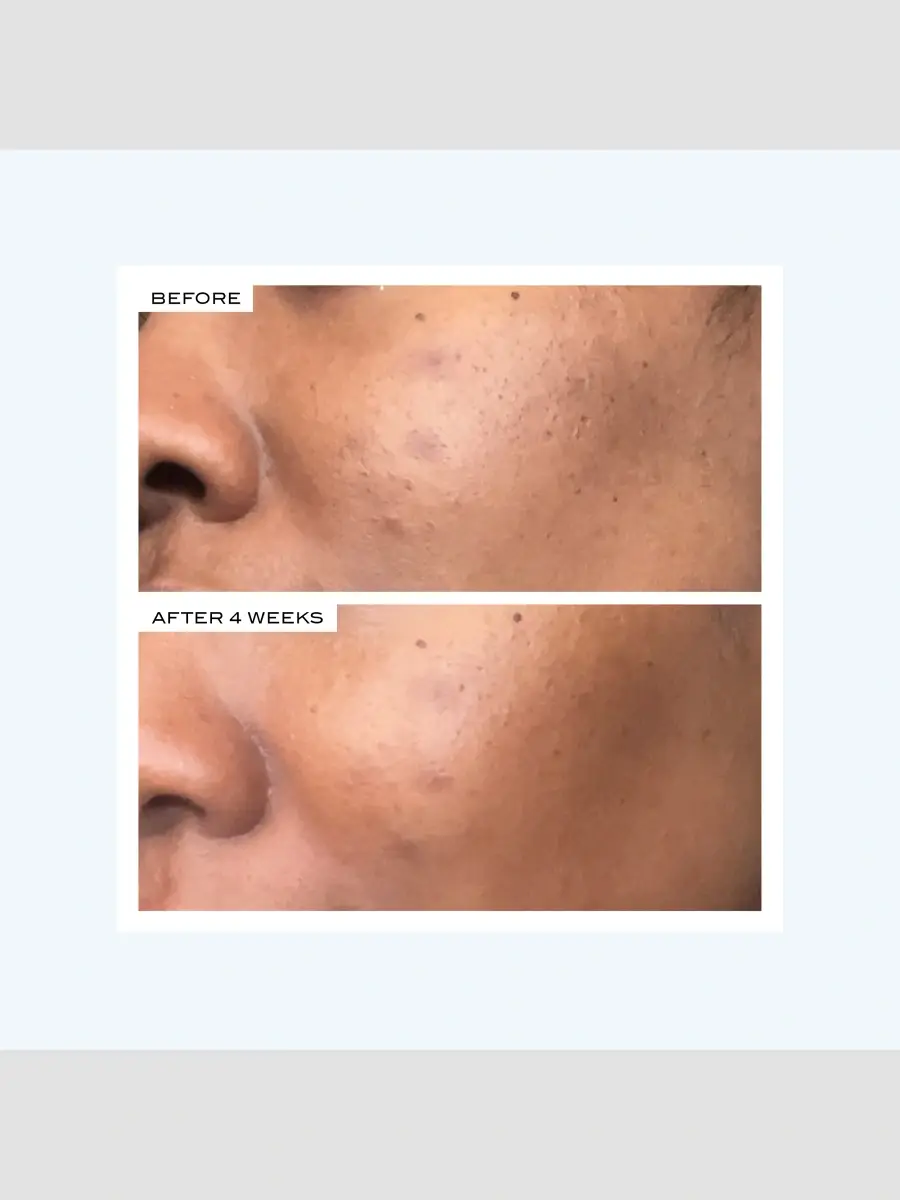 111SKIN Precision Peel | Thumbnail 7 111SKIN Precision Peel | Thumbnail 7