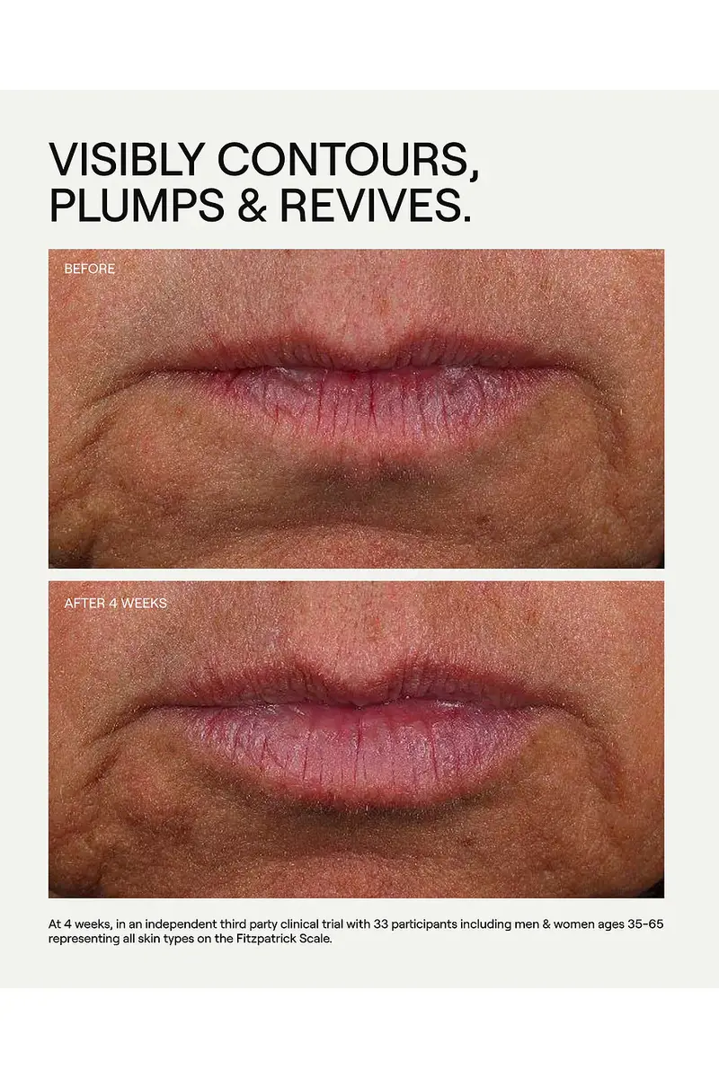 Dr. Diamond's Metacine Liplift Hyaluron Peptide-6 BioFill Lip Treatment | Thumbnail 8 Dr. Diamond's Metacine Liplift Hyaluron Peptide-6 BioFill Lip Treatment | Thumbnail 8