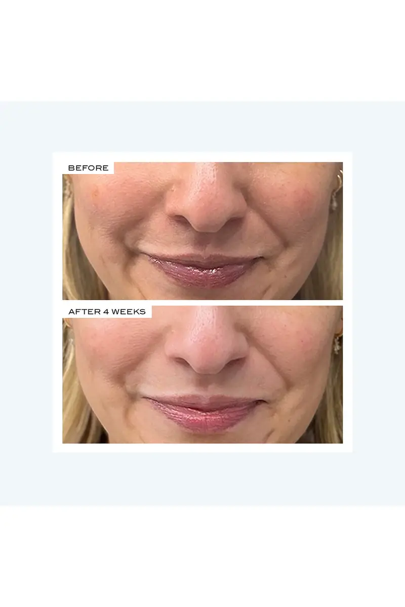 111SKIN Precision Peel | Thumbnail 7 111SKIN Precision Peel | Thumbnail 7