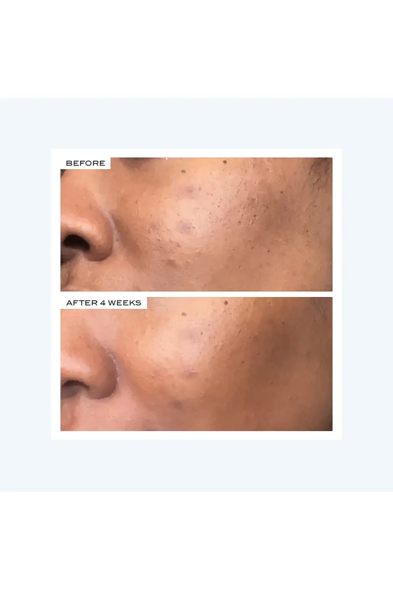 111SKIN Precision Peel | Thumbnail 8 111SKIN Precision Peel | Thumbnail 8