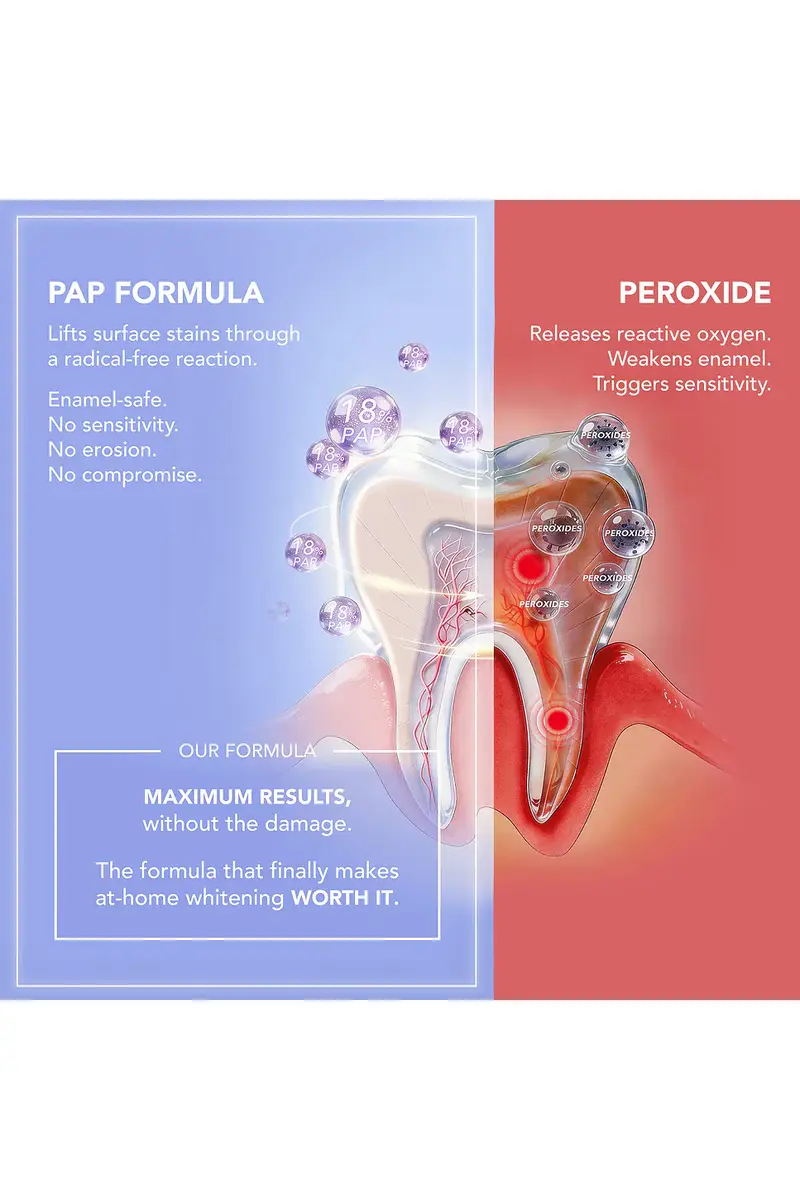 Foreo issa Dual LED + Sonic Teeth Whitening Device | Thumbnail 4 Foreo issa Dual LED + Sonic Teeth Whitening Device | Thumbnail 4