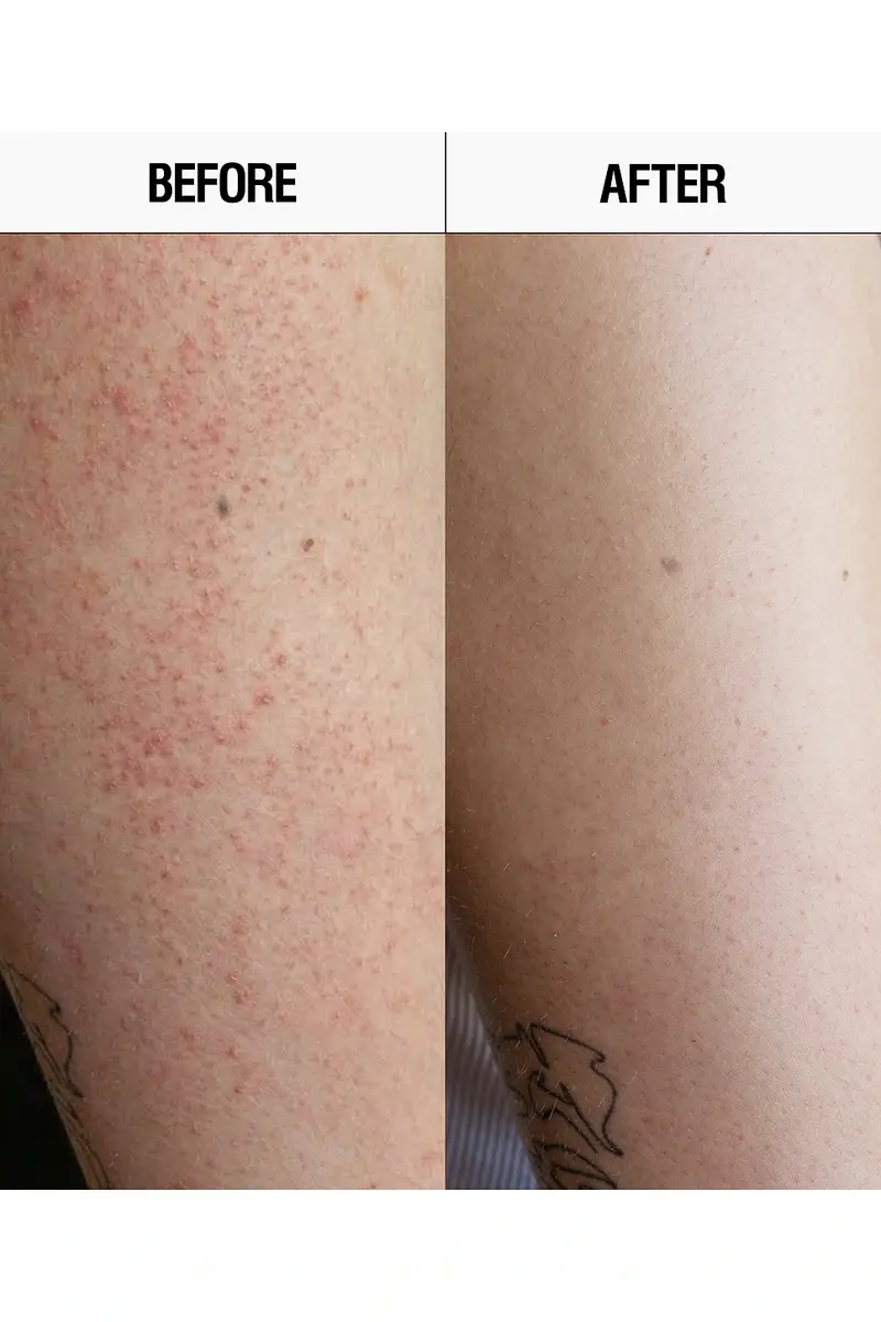 Grown Alchemist Resurfacing Targeted Body Cleanser | Thumbnail 3 Grown Alchemist Resurfacing Targeted Body Cleanser | Thumbnail 3