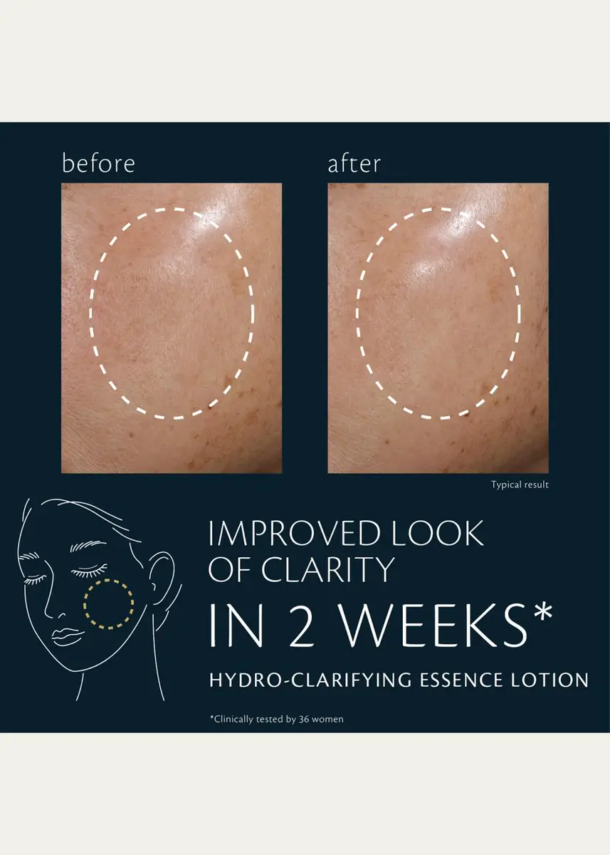 CLÉ DE PEAU BEAUTÉ Hydro-Clarifying Essence Lotion Refill, 5.7 oz. | Thumbnail 3 CLÉ DE PEAU BEAUTÉ Hydro-Clarifying Essence Lotion Refill, 5.7 oz. | Thumbnail 3