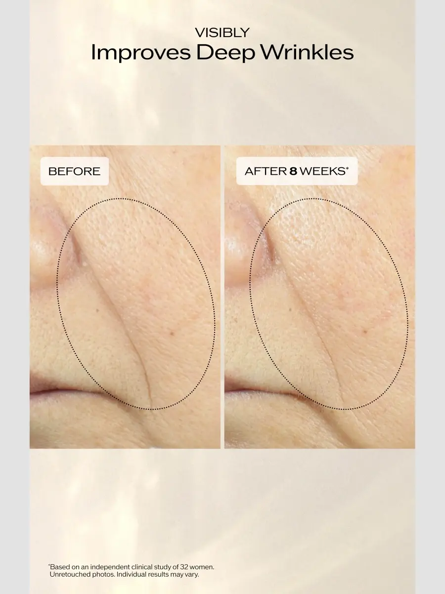 Shiseido Vital Perfection 5-Piece Set | Thumbnail 6 Shiseido Vital Perfection 5-Piece Set | Thumbnail 6