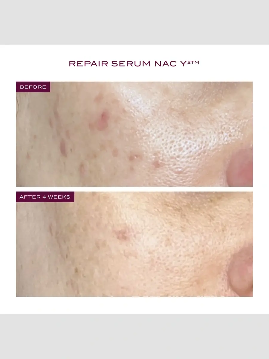 111SKIN Reparative Icons 3-Piece Skincare Set | Thumbnail 5