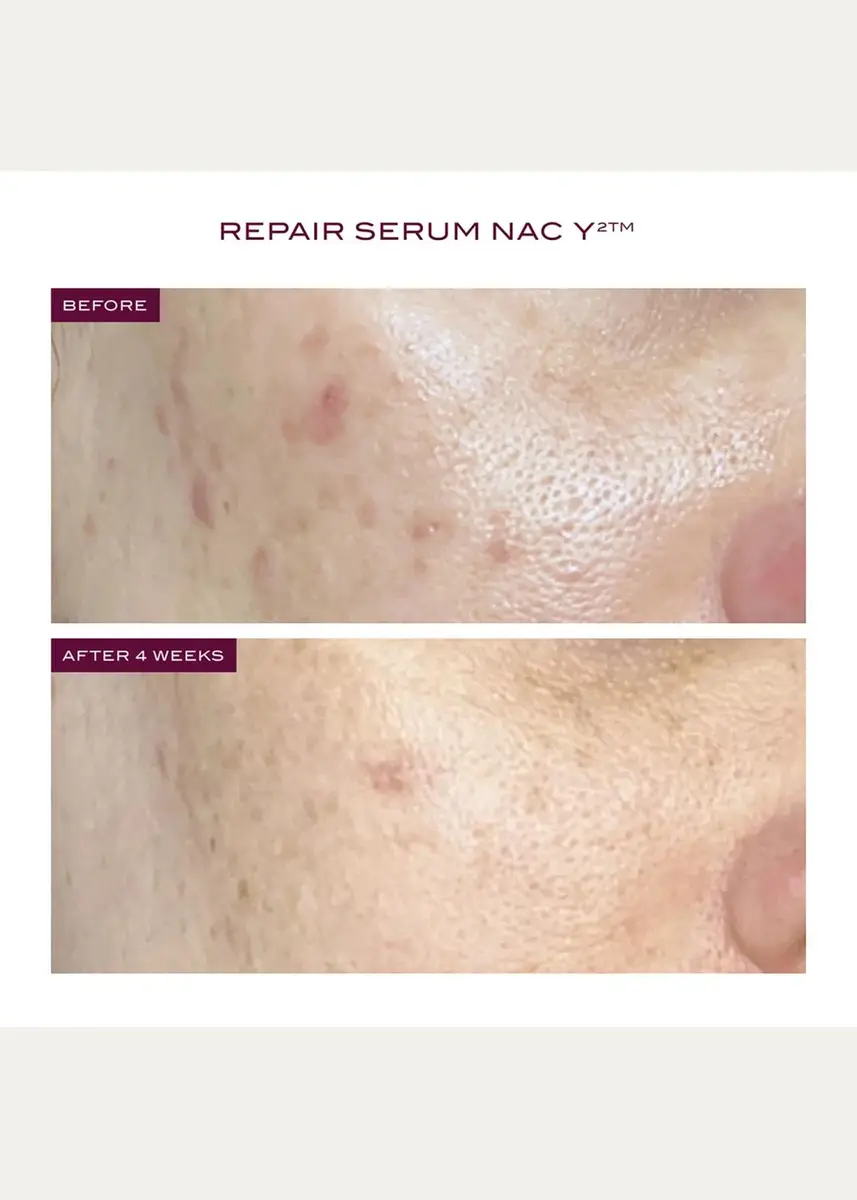 111SKIN Reparative Icons 3-Piece Skincare Set ($445 Value) | Thumbnail 5 111SKIN Reparative Icons 3-Piece Skincare Set ($445 Value) | Thumbnail 5