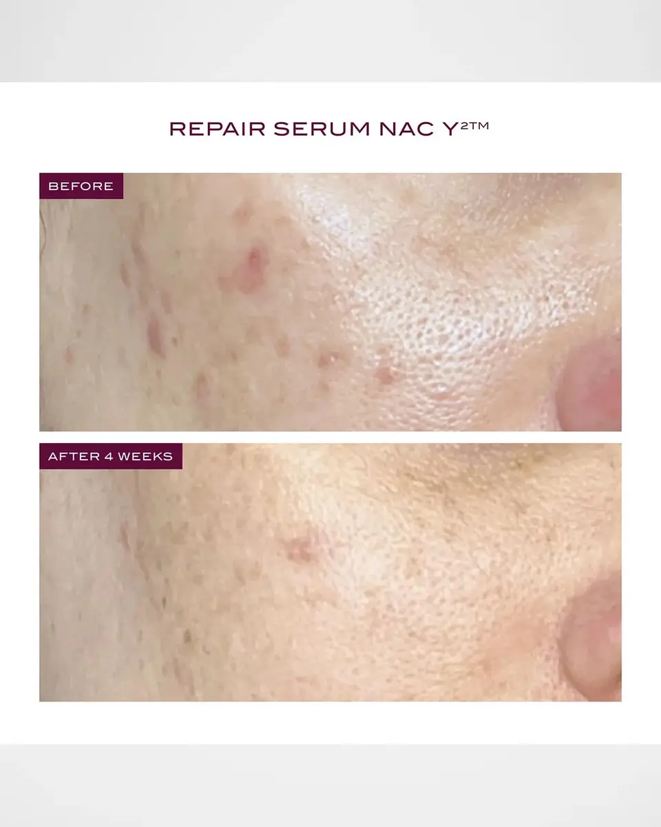 111SKIN Reparative Icons 3-Piece Skincare Set ($445 Value) | Thumbnail 5 111SKIN Reparative Icons 3-Piece Skincare Set ($445 Value) | Thumbnail 5