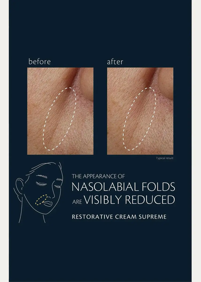 CLÉ DE PEAU BEAUTÉ Restorative Cream Supreme | Thumbnail 4 CLÉ DE PEAU BEAUTÉ Restorative Cream Supreme | Thumbnail 4