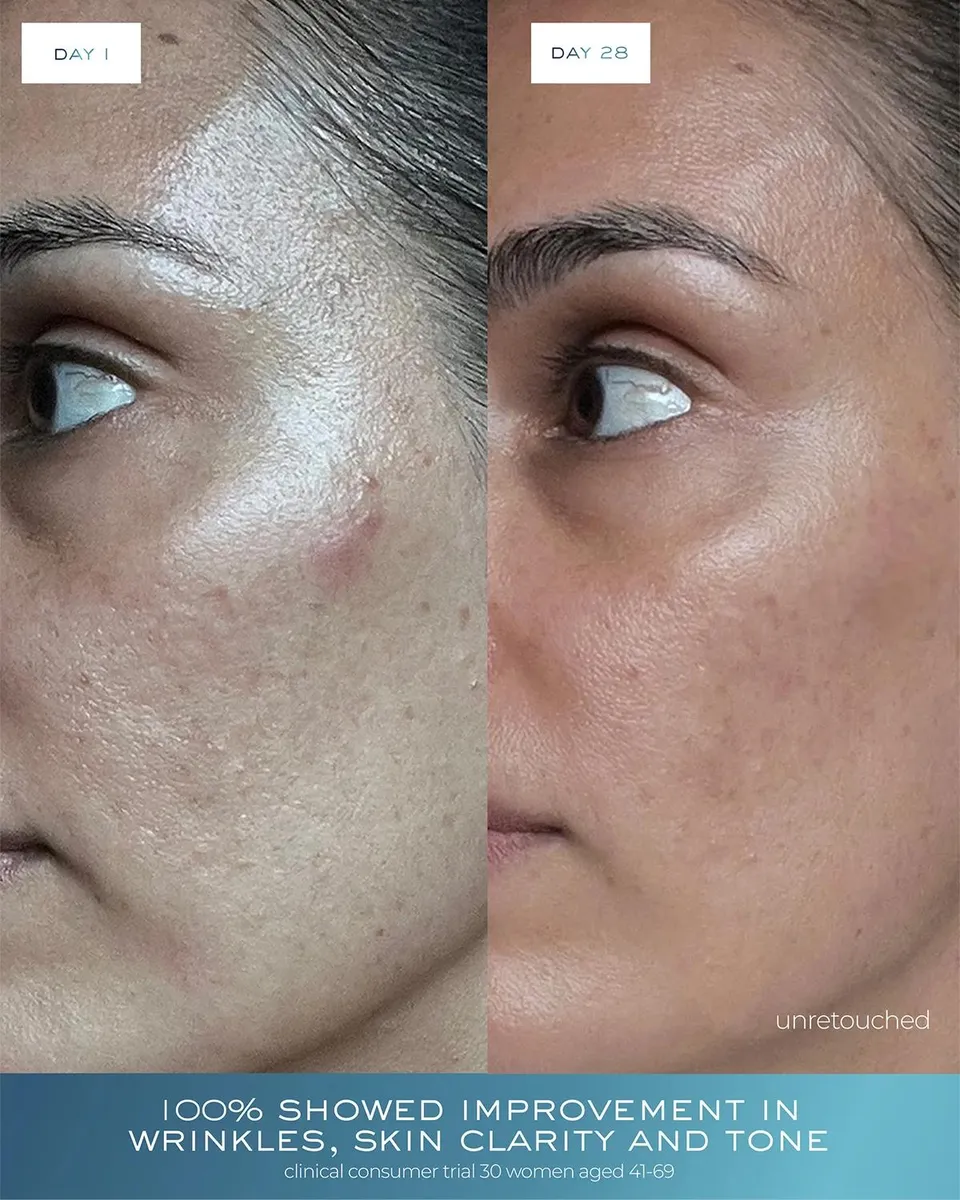Element Eight O2 Skin Longevity Duo | Thumbnail 5 Element Eight O2 Skin Longevity Duo | Thumbnail 5
